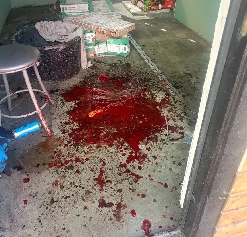 Ссора в очереди закончилась ножевым ранением