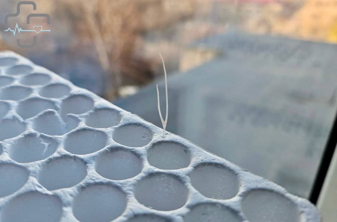 Врачи спасли пациента, удалив кость из горла