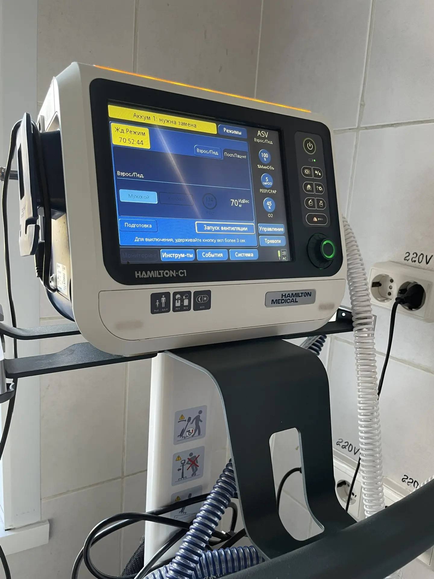 Трехлетний ребенок, упавший со второго этажа, находится в критическом состоянии